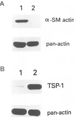 FIG. 6.  Western  blot  analysis  for  c~-SM actin  and  TSP-1.  (A)  50  nag of  total  protein  from SIE-S2  (lane  1)  or SIE-F  (lane 2)  cell  lysates  were resolved  by SDS-PAGE and  immunoblotted  with  a  monoclonal  antibody  against  c~-SM  actin