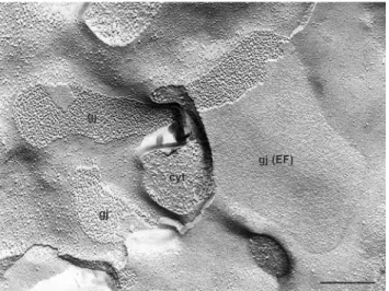 Fig. 1 Freeze-fracture electron micrograph illustrating the typical structure of gap junctions (gj) at the cardiac intercalated disk