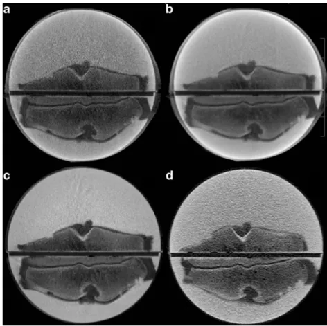 Fig. 1 Axial images of advanced joint phantoms tibial epiphyses of cadaveric pig knees mounted in a  bi-hemispheric plastic model filled with iodinated contrast agent (in this example, at an iodine  con-centration of 45 mg/ml)