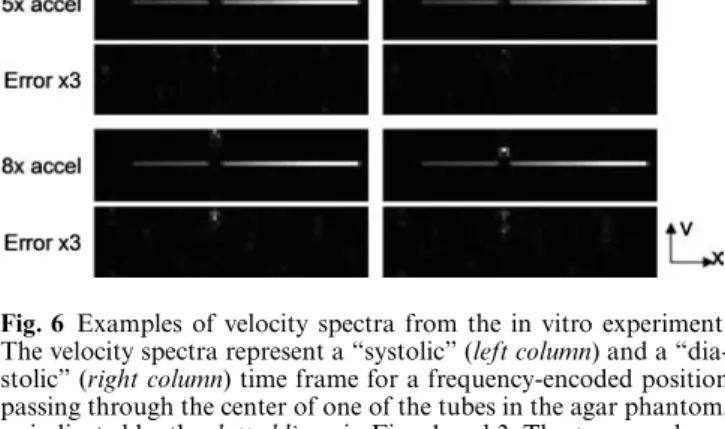 Fig. 6 Examples of velocity spectra from the in vitro experiment.