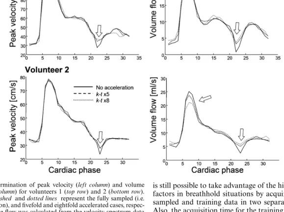 Fig. 10 Determination of peak velocity (left column) and volume ﬂow (right column) for volunteers 1 (top row) and 2 (bottom row).
