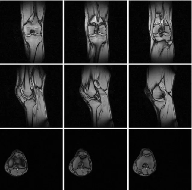 FIGURE 2. One example for the scout images (2D gradient echo sequence, T R 5 7.7 ms and T E 5 3.67 ms), on which the Chamfer matching for OBB definition is performed