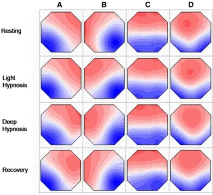 Figure 1 illustrates the mean maps across participants of the four microstate classes for each of the four  experi-mental conditions