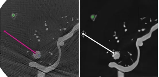 Fig. 3 Screenshot from the application software presenting one CBCT (left) and MDCT (right) slice