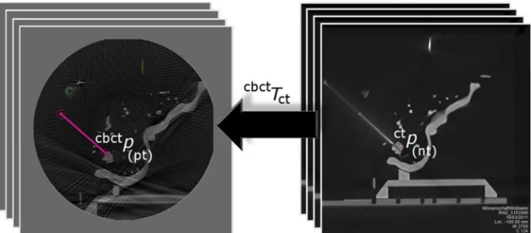 Fig. 4 CBCT-to-CT rigid image coregistration process for TPE evaluation. When SM-based image coregistration is performed, the achieved needle tip position ct p ðntÞ in a ct coordinate system (right) is transformed via the affine transformation matrix cbct 