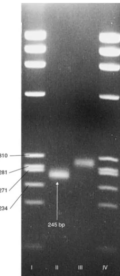 Fig. 1 Agarose gel analysis of PCR products. PCR products were electrophoretically separated electrophoresed on a 2.5% agarose gel and visualised by ethidium bromide staining