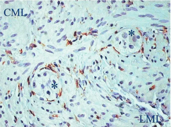 Fig. 2 Interstitial cells of Cajal (ICC) (stained brown) in a normal colon segment. CML circular muscle layer, LML longitudinal muscle layer,