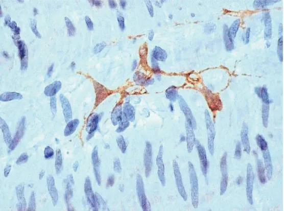 Fig. 4 Interstitial cells of Cajal (ICC) (stained brown) in the circular muscle layer of an aganglionic colon segment (c-Kit immunohistochemistry,