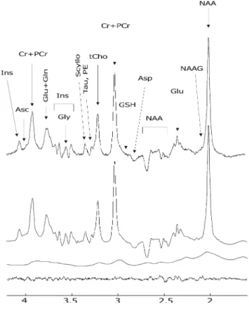 Fig. 2 In vivo 1 H MR spectrum at 7 T, LCModel fit, LCModel fit of the macromolecule spectrum and residuals (from top to bottom), at TE