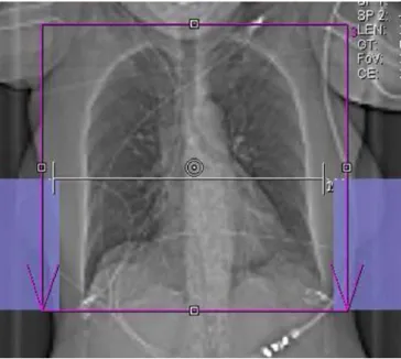 Fig. 1 Scan topogram illustrating planning of the chest pain protocol. The scan range covered the entire chest (red box).