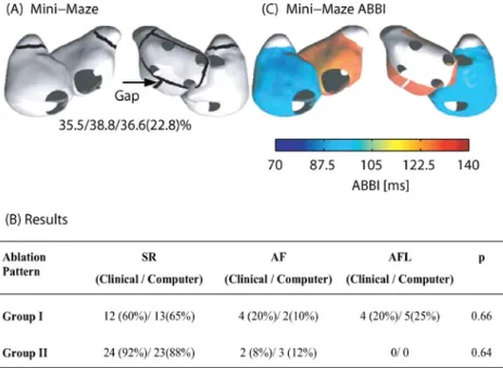 FIGURE 5. Comparison between computer simulations and clinical experiments. (A) Mini-Maze pattern