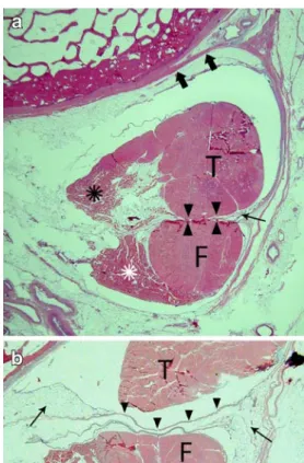 Fig. 3 Irregular tendon surface in proton density-weighted MR images at the chiasma cruris