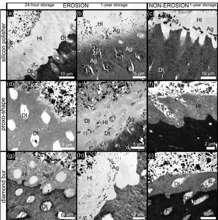 Fig. 3 TEM photomicrographs of OptiBond FL (Kerr) speci- speci-mens. a The use of a silicon polisher did not sufficiently reduce the depth of demineralized (eroded) dentin