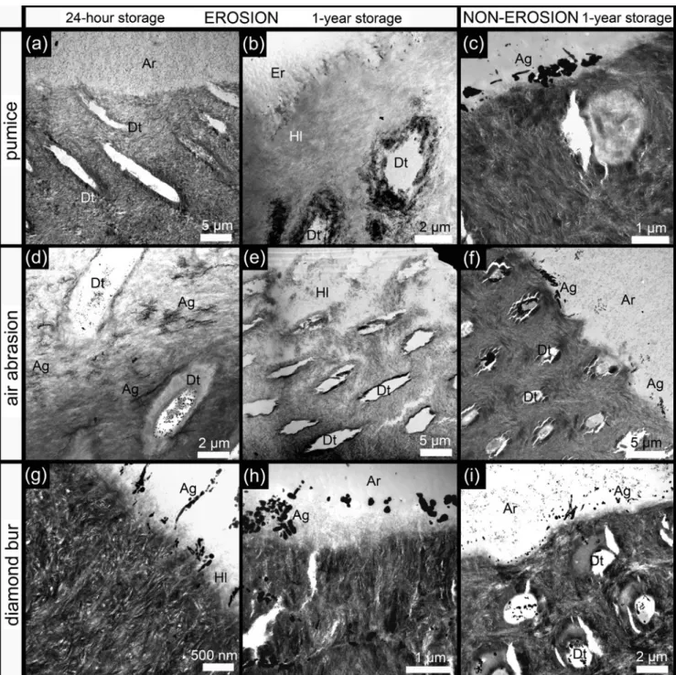 Fig. 4 TEM photomicrographs of Clearfil SE Bond (Kuraray) speci- speci-mens. a Scrubbing the surface with pumice appeared to have been quite effective to remove the most outer zone of the demineralized (eroded) dentin