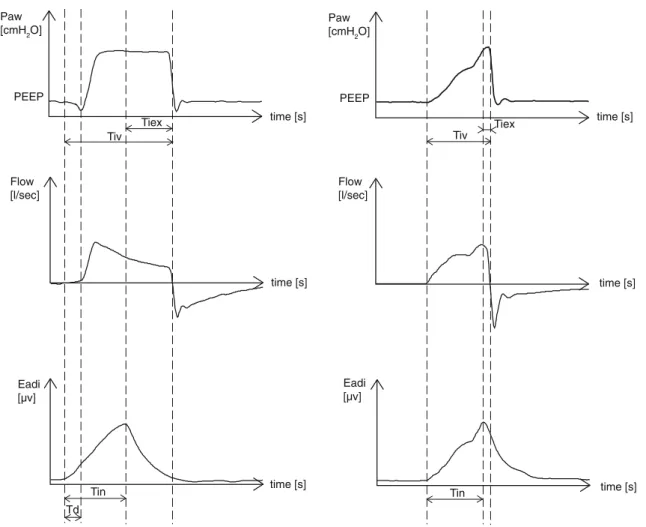 Fig. 1 Airway pressure, flow, and electrical diaphragmatic activity curves in pressure support and in neurally adjusted ventilatory assist.