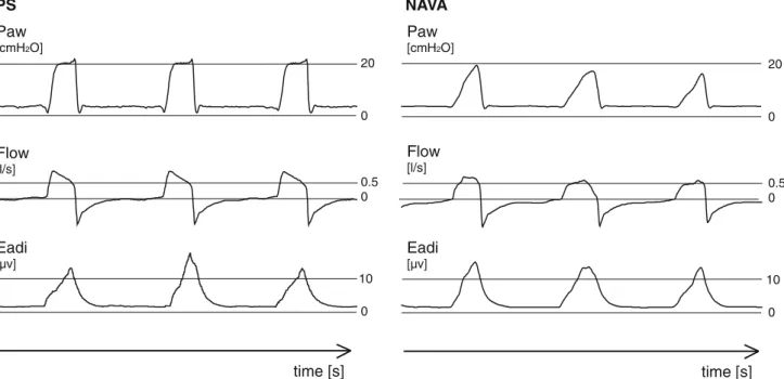 Fig. 3 Typical recording in pressure support and in NAVA. Paw airway pressure, Eadi electrical activity of the diaphragm