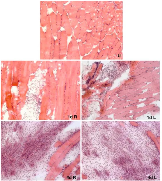 Fig. 6 Left TA muscle histology 1 and 4 days post-injection of human fetal skeletal muscle cells