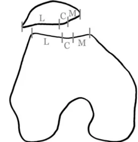Fig. 4 On the patellar and the femoral side, the cartilage was subdivided into three zones: medial (M), central (C) and lateral (L), for differentiated assessment of cartilaginous changes