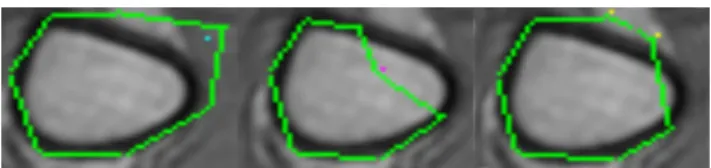 Fig. 3 Example of constraint points on an MRI image. The blue (left), red (middle) and yellow (right) points represent the internal, external and frontier points, respectively