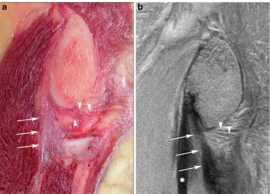 Table 4 Imaging. Anatomic correlation