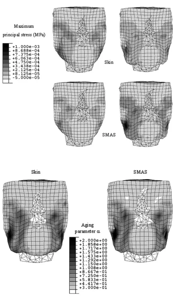 Fig. 7 Early and ﬁnal distributions of the maximum principal Cauchy stress in both the skin and SMAS layers