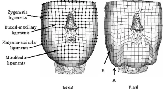 Figure 7 shows distributions of the maximum prin- prin-cipal Cauchy stress in both the skin and SMAS layers at early (shortly after the tissues equilibrate the gravity load) and ﬁnal stages of the calculation