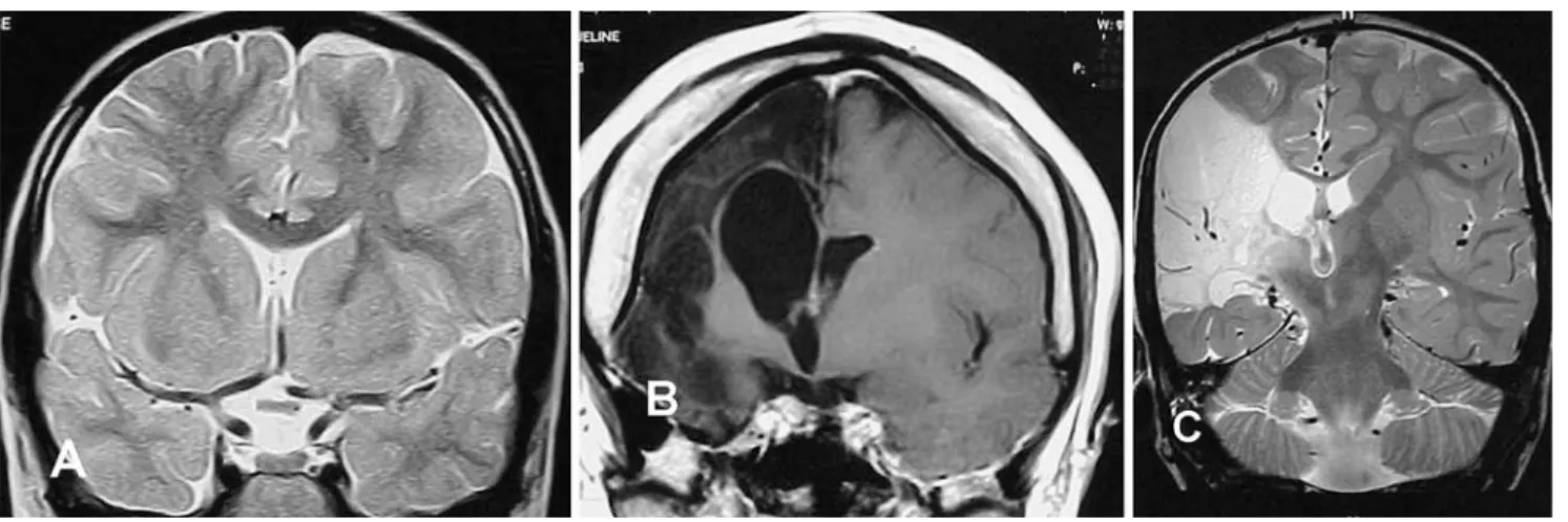Fig. 7 Anatomical preparation.