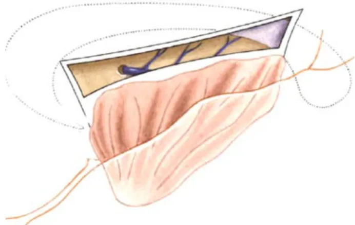 Fig. 12 Suprasylvian — coronal — section of corona radiata