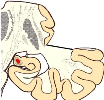 Fig. 15 Suprasylvian — lateral — site of posterior callosotomy, around