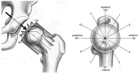 Fig. 3 a The radial MRI planes, which are perpendicular to the femoral head-neck axis, are defined on a sagittal oblique localizer