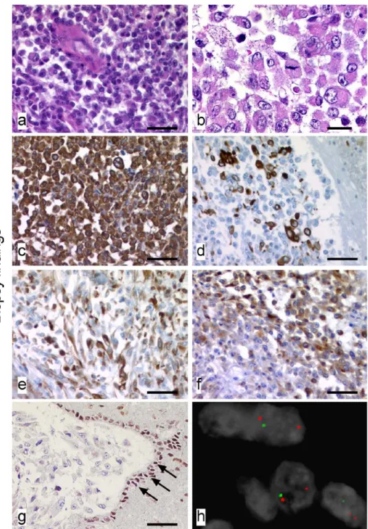 Fig. 1 Biopsy ﬁndings: