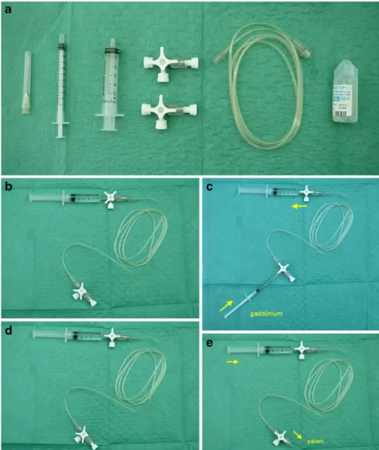 Fig. 1 Equipment and assem- assem-bly. a Materials: from left to right one needle, one 1-ml  sy-ringe, one 5-ml sysy-ringe, two stopcocks, 3-ml extension  tub-ing, and saline