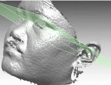 Abb. 5 Dreidimensionale Analyse – Software Rapid Form (Inus Technologies, Seoul, S¨udkorea)