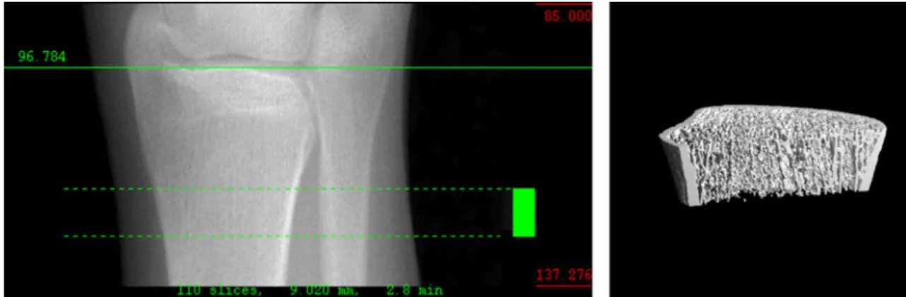 Fig. 1 a X-ray of distal tibia shows location of the VOI between green lines for analysis of vBMD and microarchitecture by HR-pQCT.