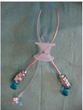 Fig. 2 Intuitive single-incision port before insertion