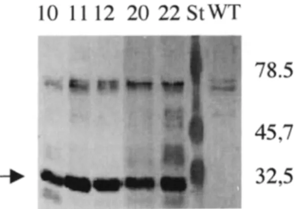 Fig.  1. Western blot analysis of leaves of transgenic potato lines expressing a 35S-oxalate  oxi-  dase  gene  construct