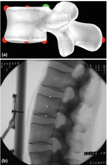 Fig. 3 Definition of initialization landmarks. a Landmarks extracted from the mean model of the PDM and b landmarks extracted from the fluoroscopic images