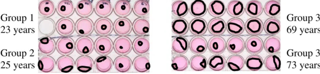 Fig. 1 The myofibroblast contraction force test in four women: on the left side, two young women of group 1 (without prolapse) and on the right side, two older women of group 3: the contraction factor of the myofibroblast-collagen gel is quantified by  mea