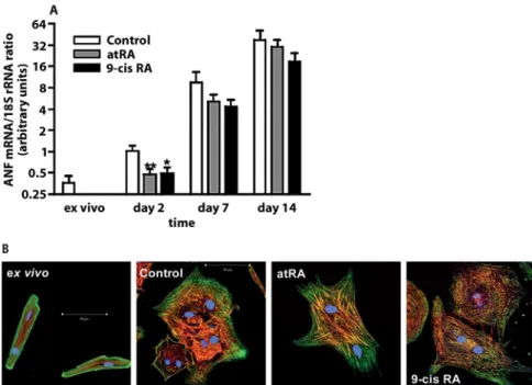 Fig. 5 Retinoic acids reduce initial ANF overexpression and increase  myofibril-lar organization in hypertrophy