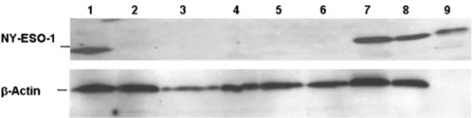 Fig. 2 Western blot analysis with anti-NY-ESO-1 antibody E978 on tumour and non-tumour tissues
