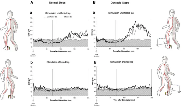 Fig. 2 Reflex responses in the deltoid muscles to tibial nerve stimulation. Grand means of the rectified reflex EMG responses in the unaffected (black lines) and the affected (grey lines) deltoid muscles to tibial nerve stimulation at the unaffected (a) an
