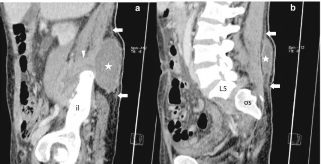 Fig. 3 Sagittal reconstructions of the patient's CT scan at admission.