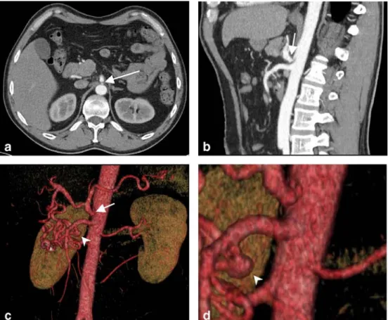 Fig. 1 A 47-year-old man with nonspecific abdominal pain.