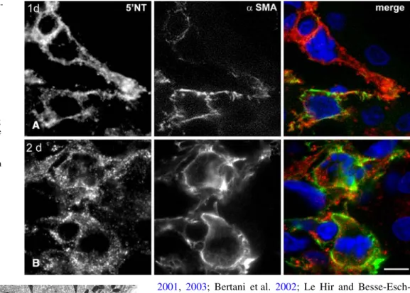 Fig. 15 Cortical peritubular Wbroblast in a focal inXammation, related to injury of a distal tubule (Transmission electron microscopy)