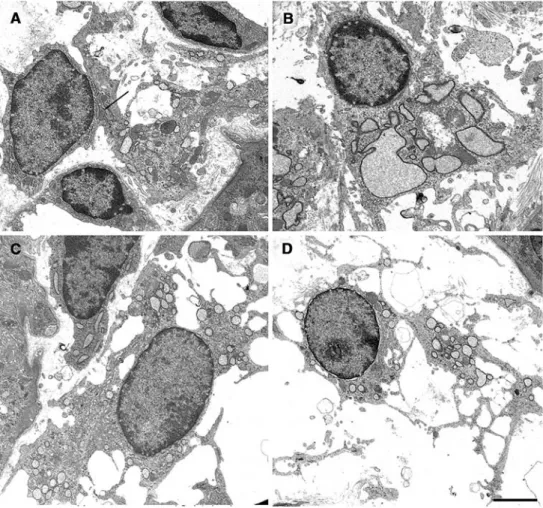 Fig. 8 Gallery of myoWbro- myoWbro-blasts (transmission electron  microscopy). MyoWbroblasts  show a heterogeneous  morphol-ogy