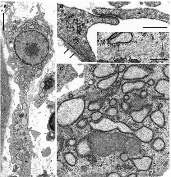 Fig. 9 MyoWbroblast in the cor- cor-tical peritubular interstitium in a  rat kidney after 3 days of ureter  ligature