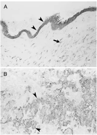 Fig. 3 Expression of MIF in amnion and placenta MIF expression in amnion epithelium. MIF expression in multinucleate trophoblast giant cells in the chorionic plate