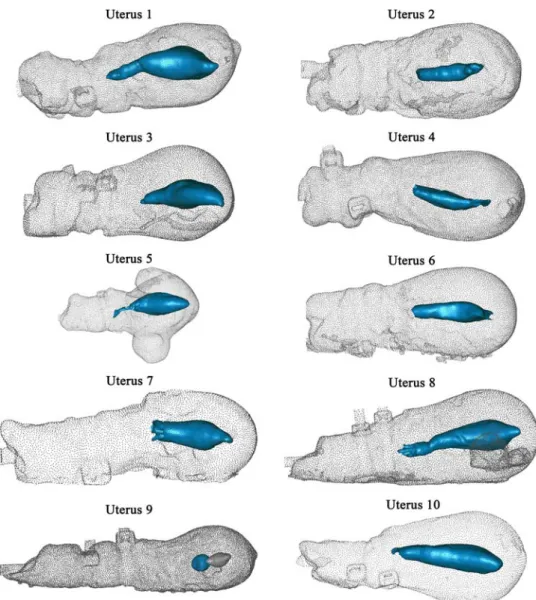 Fig. 6 Maximally deformed uterine cavities from the left side (not to the same scale).