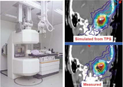 Fig. 7. The treatment room at GSI equipped with the on-beam PET detector (left). Measured and simulated data demonstrate that the dose released by carbon ions is eﬀectively conform with respect to the treatment planning