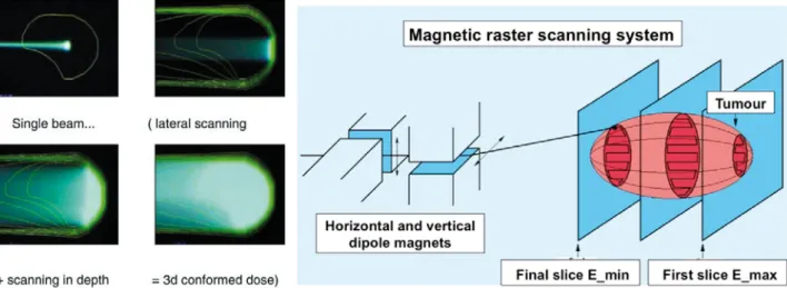 Fig. 3. Developed at PSI, the “spot scanning” technique consists in chopping the beam from a cyclotron to obtain discrete dose spots of given energy and direction which are used to form a uniform dose distribution (left)